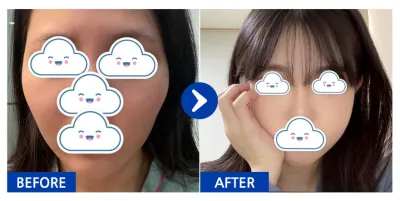 [バビトーク] 顔面輪郭 / 3ヶ月目 / ニックネーム: orini_