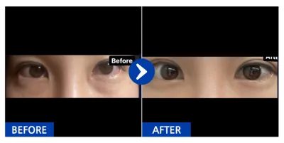 [バビトク] 二重 / 1ヶ月目 / ニックネーム : バビトクヒ