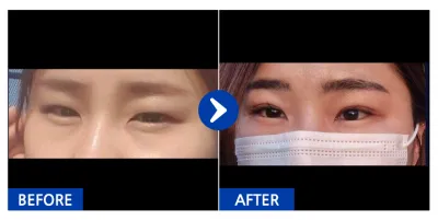 [バビトーク] 二重 / 4ヶ月目 / ニックネーム：ハツラツガール