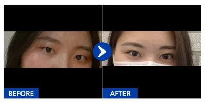 [バビトーク] 二重 / 2ヶ月目 / ニックネーム：ユリム08