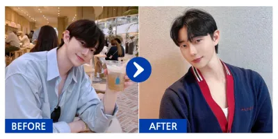 [カンナムオンニ] 目の下の脂肪再配置 / 1ヶ月目 / ニックネーム：없는게뭐야씹