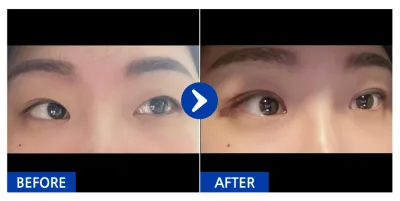 [カンナムオンニ] 自然癒着 / 3日目 / ニックネーム : CassieYu