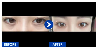 [バビトーク] 自然癒着 / 2週目 / ニックネーム：ユンバク