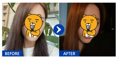 [カンナムオンニ] 頬骨 1ヶ月目 / ニックネーム：ユフフフフㅜ