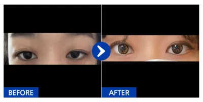 [バビトーク] 自然癒着 / 2週目 / ニックネーム：トゥニと友達