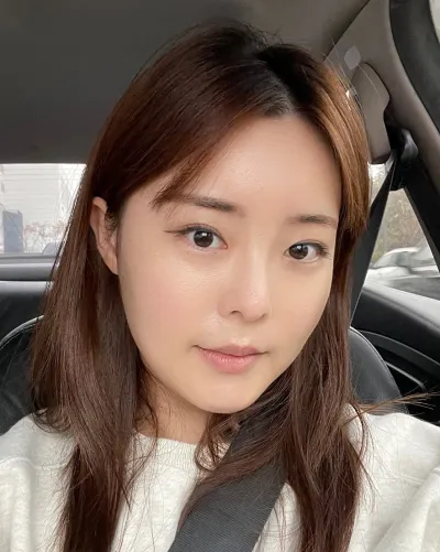 [目] チョコ초 - 埋没法二重術（再手術）