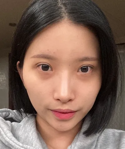 [目] ベビーキャット - 目尻切開、グラマラスライン形成