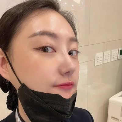 [鼻] 銀河水 - 鼻筋、鼻先、骨切り、ハンプ修正