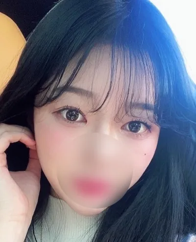 [目] ポモドーロ - 切開二重(再手術)