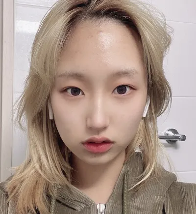 [目] 雪の華 - 切らない眼瞼下垂手術、目尻切開