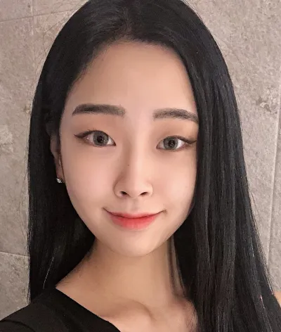 [目] ナラ - 埋没法二重、目尻切開、タレ目形成