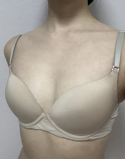 [豊胸] タマ - バスト