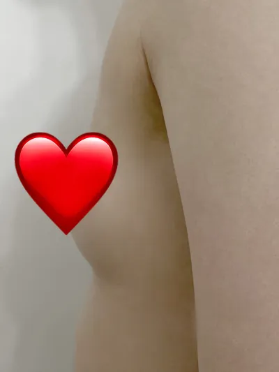 [豊胸] エネエナジー - 胸