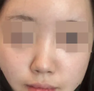 [鼻] アンインウンオアン - 鼻