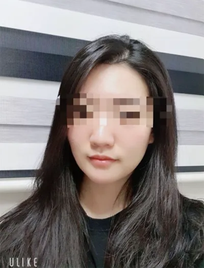 [쁘띠] [準会員ngR5DA2] - シュリンク、ボトックス