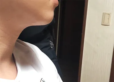 [皮膚] ㄱガン - シュリンク