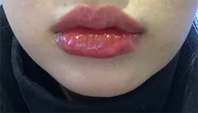 [プチ] アンコ - 唇