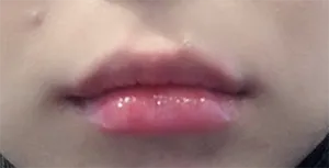 [プチ] ナ・セッピョル - 唇