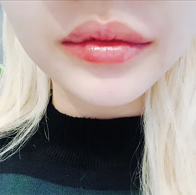 [쁘띠] ゴミ00 - 唇
