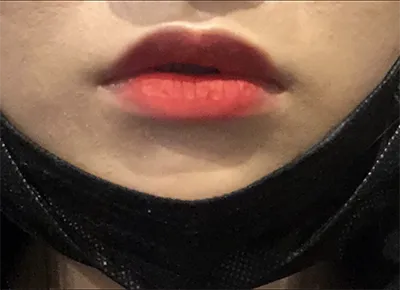 [쁘띠] イムミ - 唇