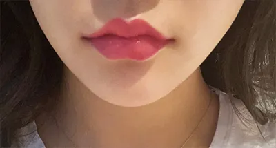 [プチ]キャッキャッ - 唇