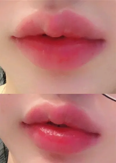 [쁘띠] ユンユンユンユンユンユン2 - 唇フィラー