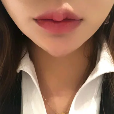 [プチ] チョン様 - 唇フィラー