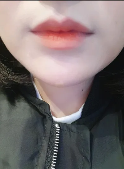 [プチ] kkd0229 - 唇フィラー