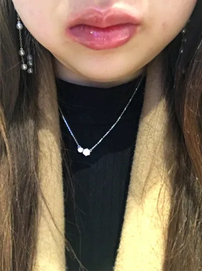 [プチ] ペゴプチャチャ - 唇フィラー、ボトックス