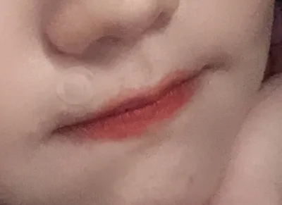 [쁘띠] vv림b27 - 唇フィラー