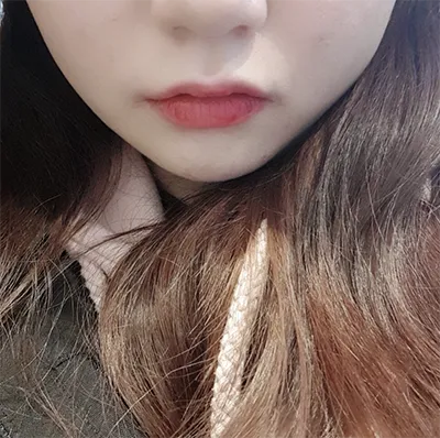 [쁘띠] チャン이야아 - シュリンク、ボトックス