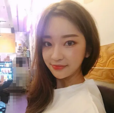 [目] メイ123 - 目、脂肪移植