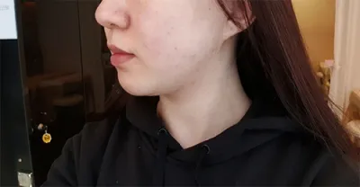 [皮膚] シロママシマロ - シュリンク400ショット