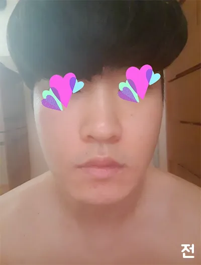 [皮膚]簡単だよ - シュリンク