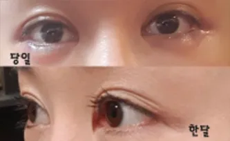 [目] ホシホシホシ18 - 目