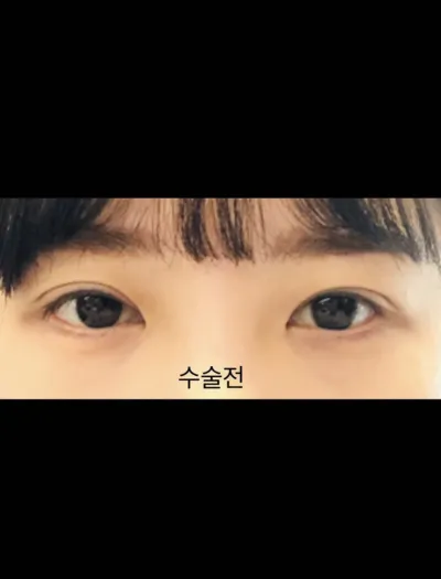 [目] ジュヒ95 - 目