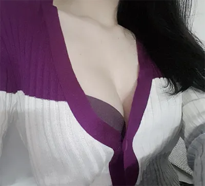 [豊胸] ユジン767 - 胸