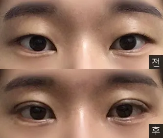 [目] クルミマルグム - 目