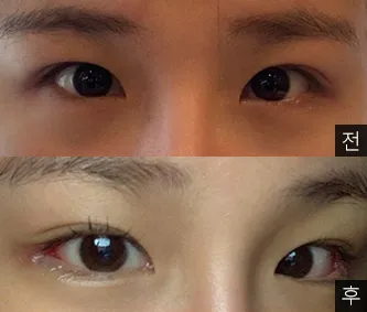 [目] タルイチャン姉さん - 目