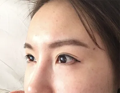 [目] ライライライ - 目