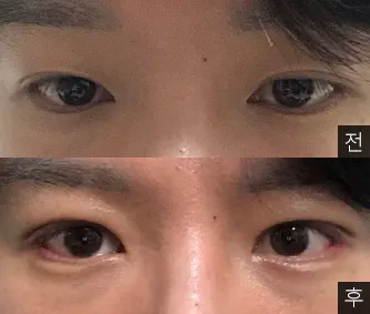 [目] チャンバク - 目