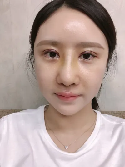 [鼻] ジェニブリ - 目、鼻