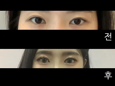 [目] ヒョナッチュ - 目