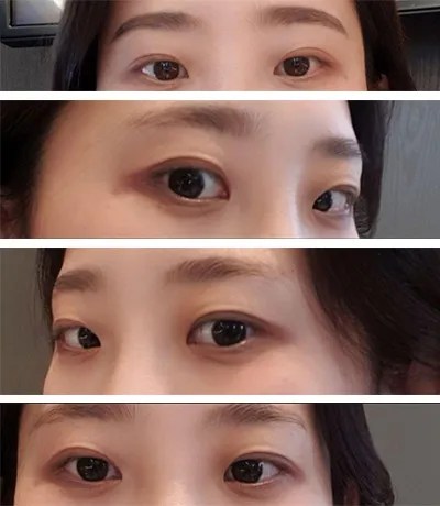 [目] ススス花 - 目