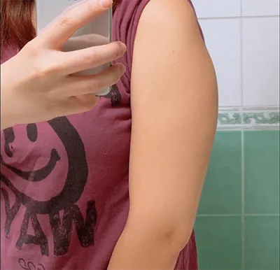 [脂肪吸引] ブルーベリーヨン - 脂肪吸引