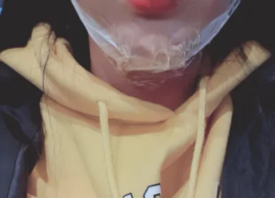 [皮膚] 気になる - エアージェット