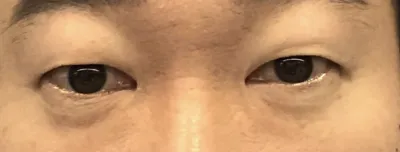 [目] プダダ - 目