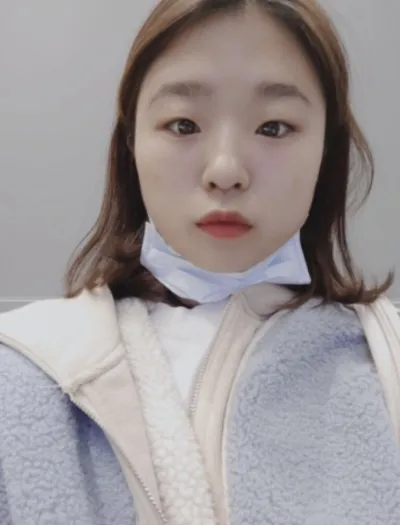 [プチ] ヒョンホンヘン - 目の下、ボトックス、フィラー