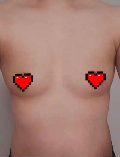 [豊胸] おおイェー - 胸