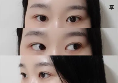 [目] ギソプ - 目